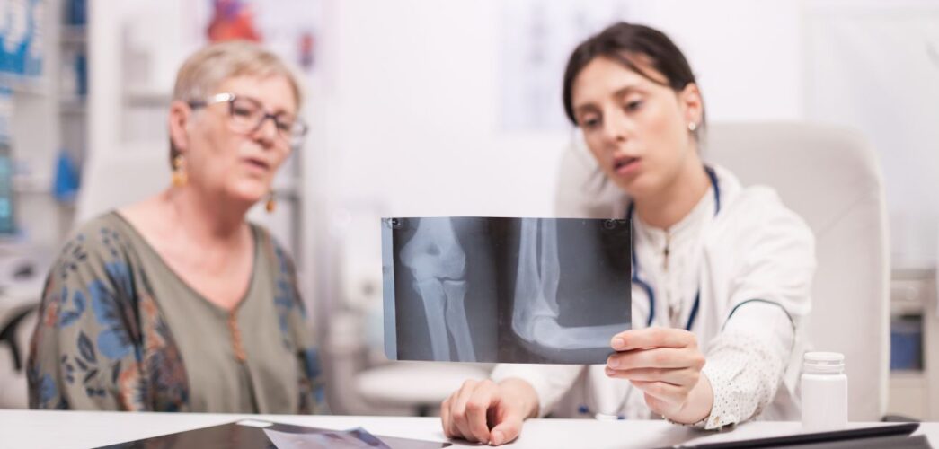 Osteoporoza. Jak zapobiegać łamliwości kości po 50-tce?